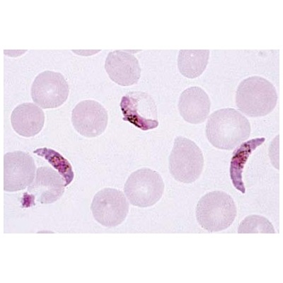 This image has an empty alt attribute; its file name is 27840_400x400.jpg